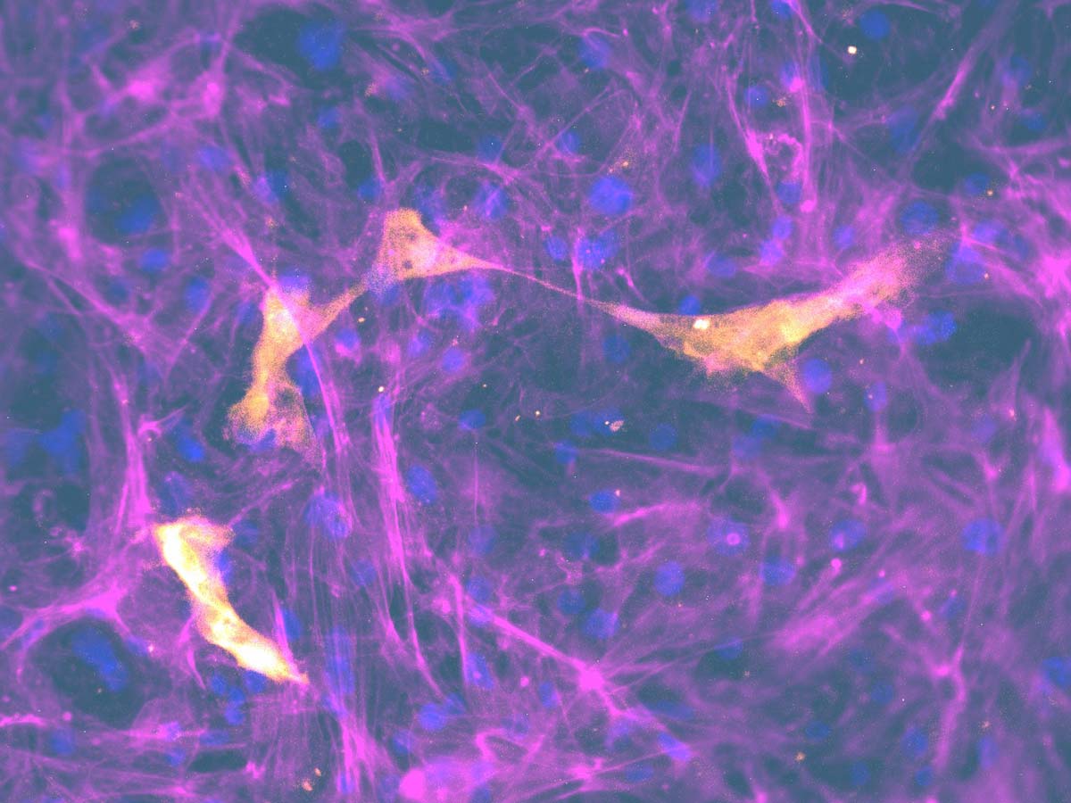 COVID cells